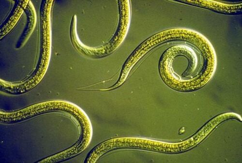 Паразитски нематодни црви во човечкото тенко црево
