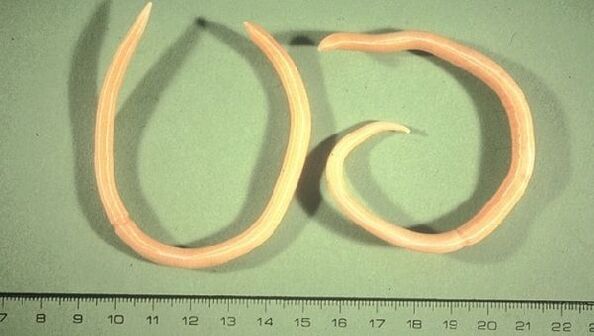 Тркалезни црви - црви кои се манифестираат со замор и кашлица